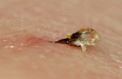 Жало пчелы с мешочком яда