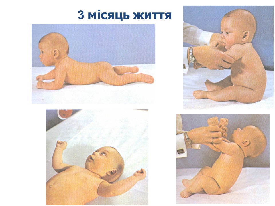 Фото дитини в 3-й місяць життя