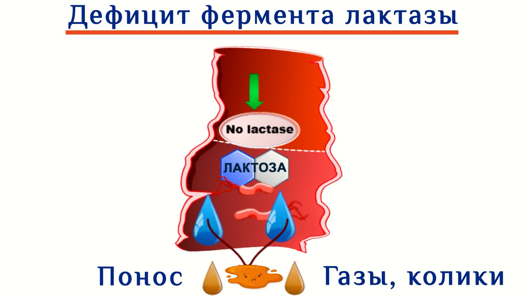 Дефицит фермента лактазы у малыша. Причины возникновения. Схема для ознакомления