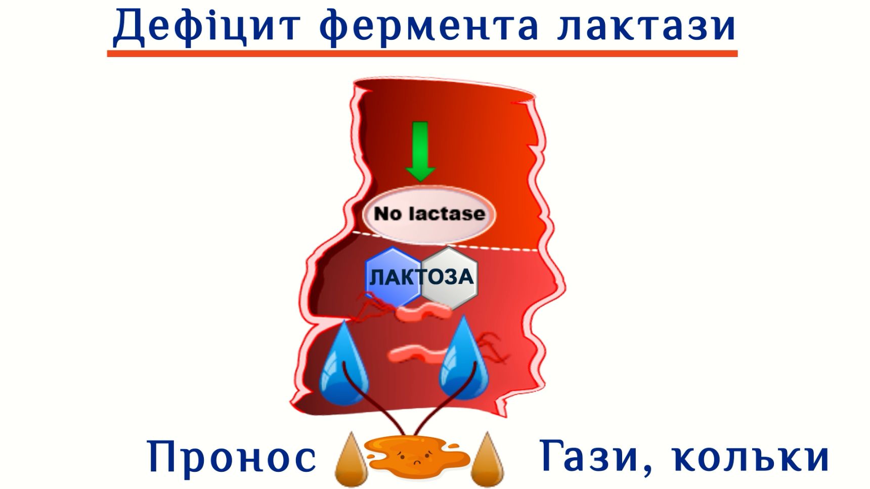 Дефіцит фермента лактази в малюка. Причини виникнення. Схема для ознайомлення