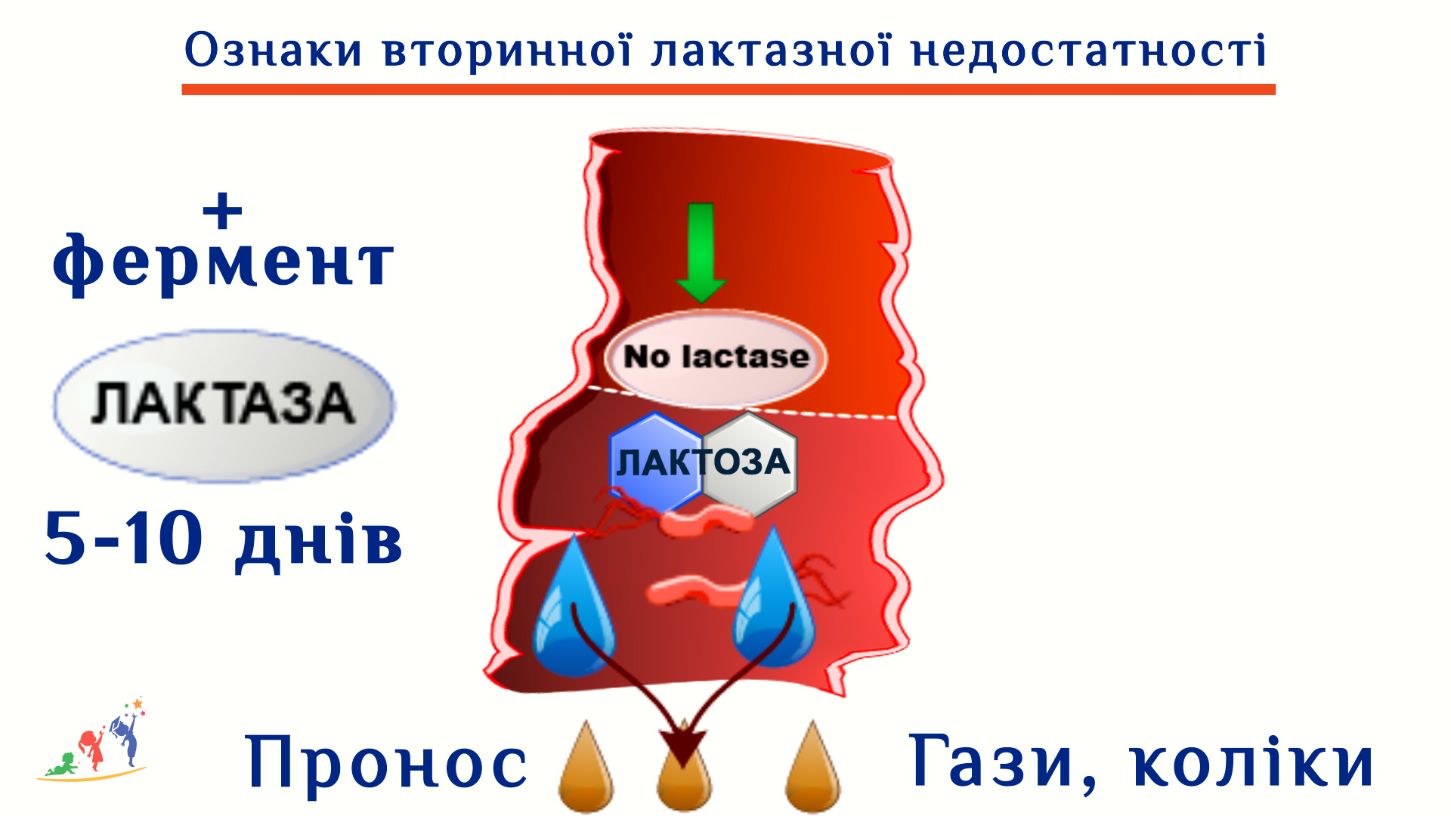 Ознаки вторинної лактазної недостатности. Таблиця