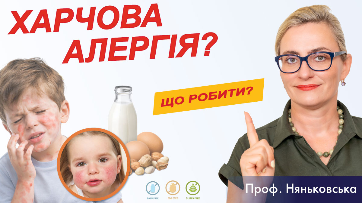 Алергія у дітей симптоми, червоні щічки після їжі та як визначити харчову алергію 